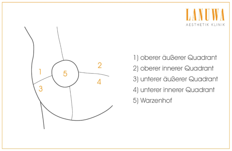 Einteilung der Brust in vier Quadranten Die vier Quadranten der weiblichen Brust mit Warzenhof