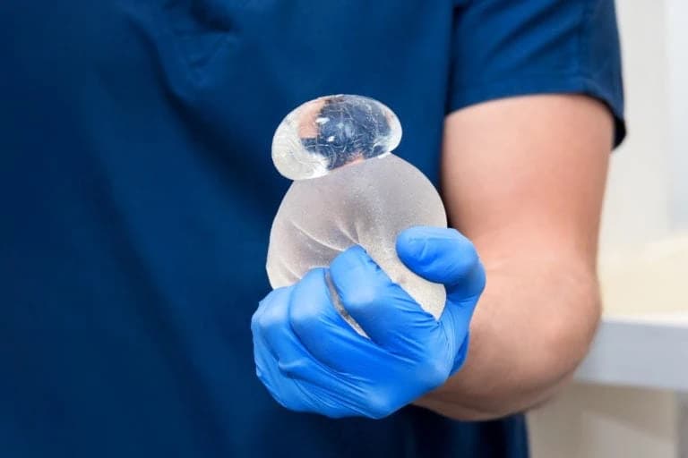 Beschädigtes Brustimplantat mit kohäsivem Silikongel Arzt hält ein beschädigtes Brustimplantat mit auslaufendem Silikongel in der Hand