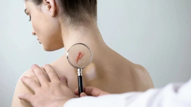 Bei Schmerzen oder Spannungen die Wunde oder Narbe medizinisch untersuchen lassen Ärztin untersucht Narbe am Rücken einer Patientin